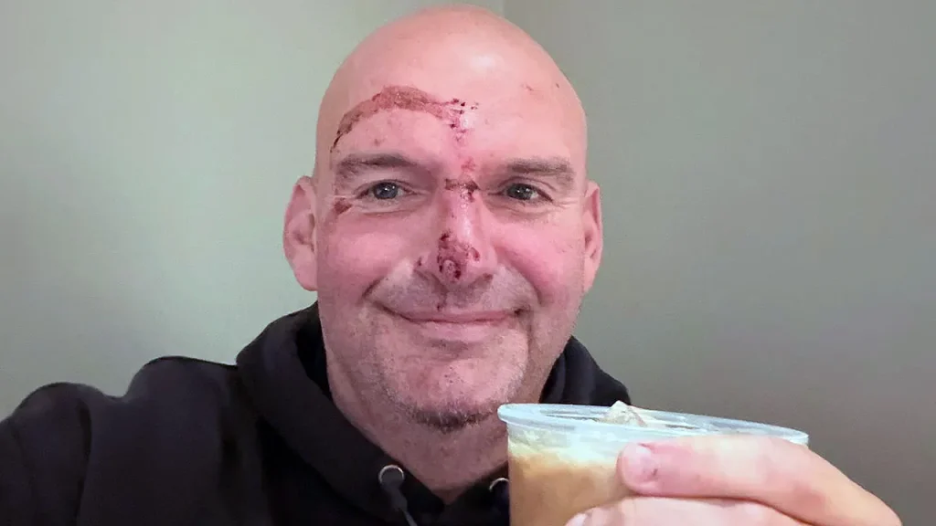 Fetterman Shares Recovery Photo After Heart Procedure, Thanks Medical Team