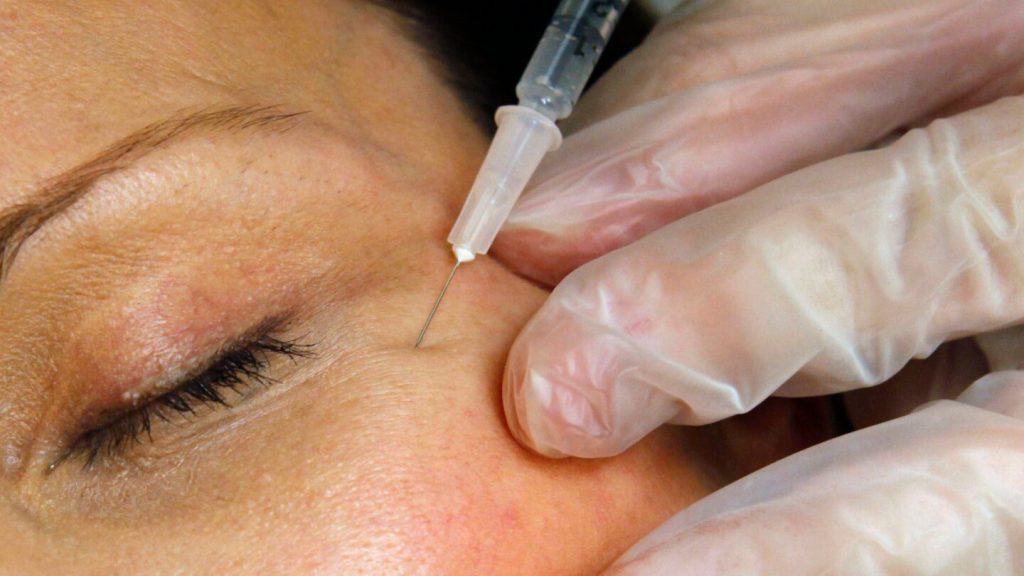 FDA warns websites selling unapproved Botox for cosmetic purposes