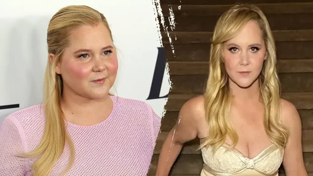 Cushing’s Syndrome: Understanding the Condition Behind Amy Schumer’s Weight Loss