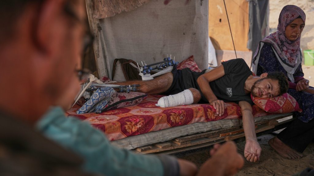Gaza amputees struggle to rebuild lives as the enclave faces shortages of prosthetic limbs