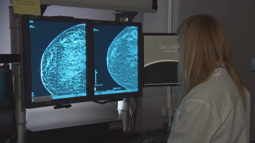 Mammogram Safety in Saskatchewan Plagued by Online Misinformation