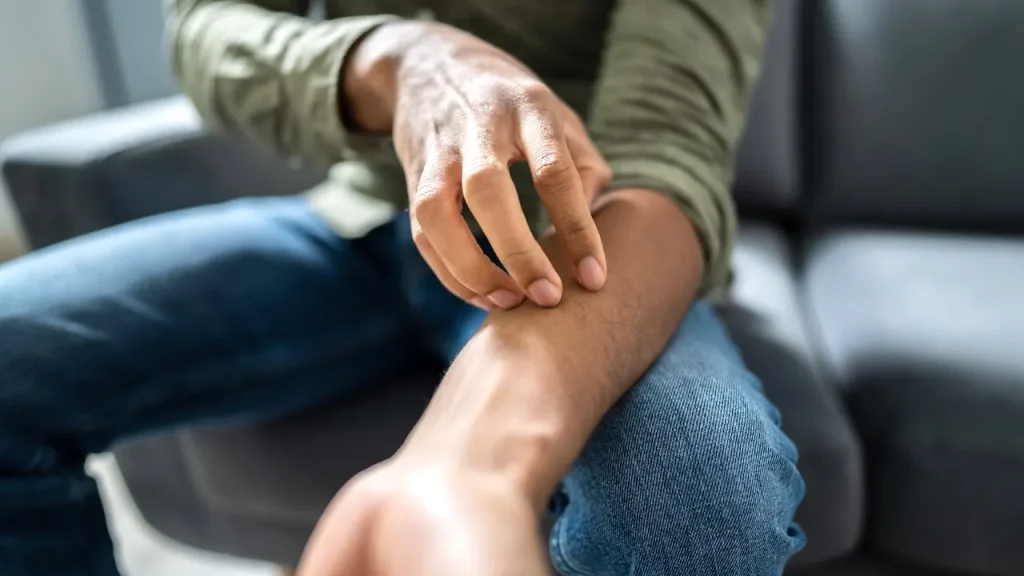 State Confirms Outbreak of Sexually Transmitted Fungal Infection; Experts Urge Caution