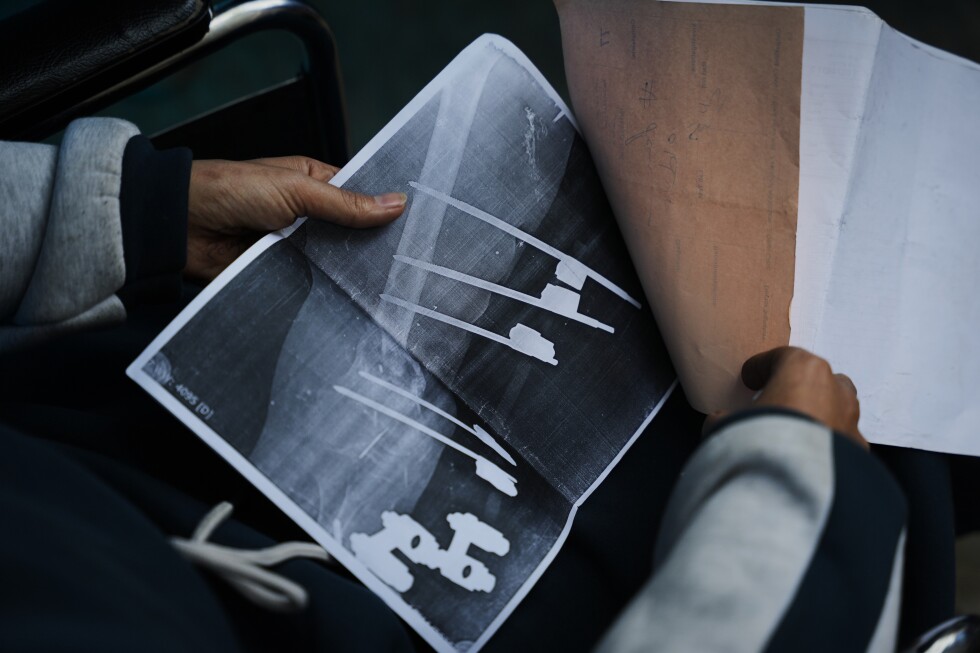 A bullet shattered her knee. Now a Gaza teen’s chances of walking depend on Rafah crossing’s opening