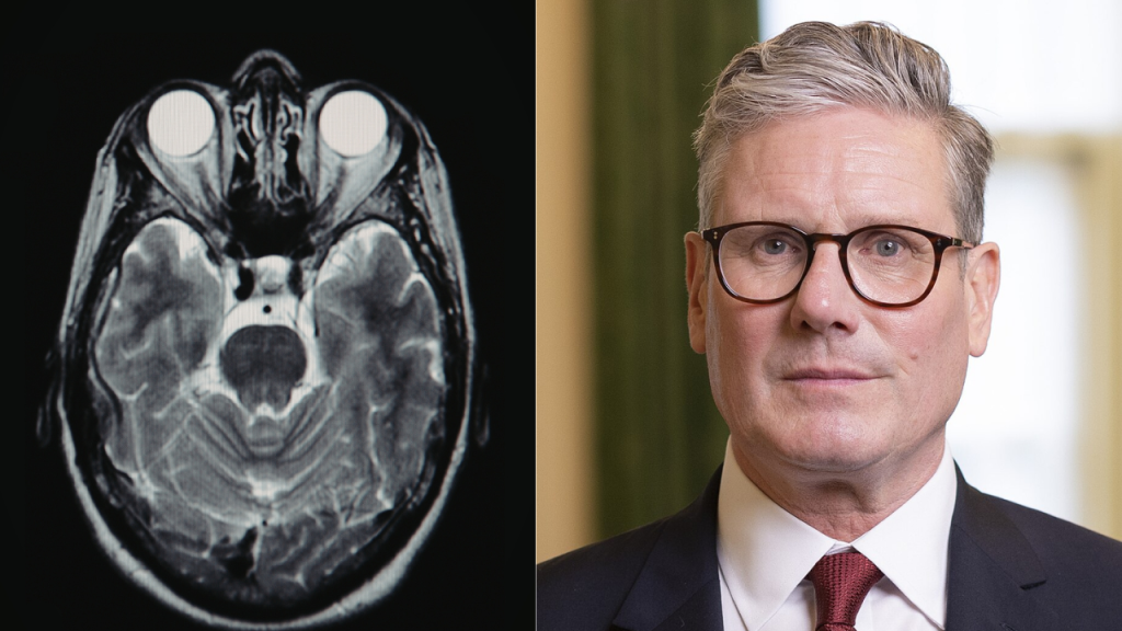 Fact Check: Did Keir Starmer Suggest Lockdown Possibility for Rising Meningitis Cases?