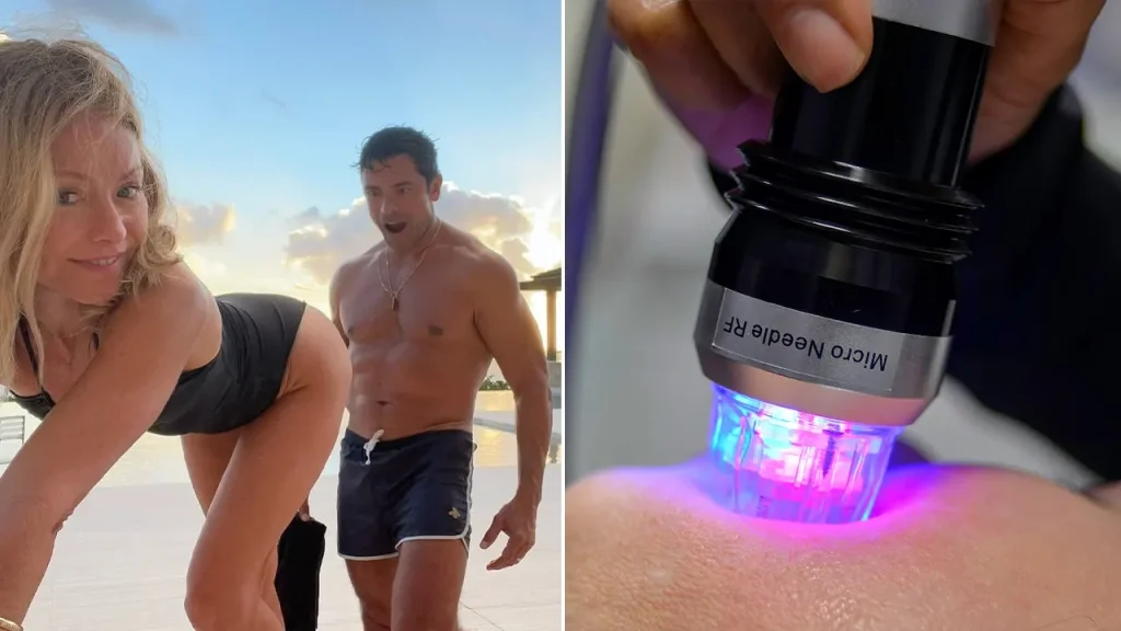 Kelly Ripa Reveals Experience with Gluteal Microneedling Procedure