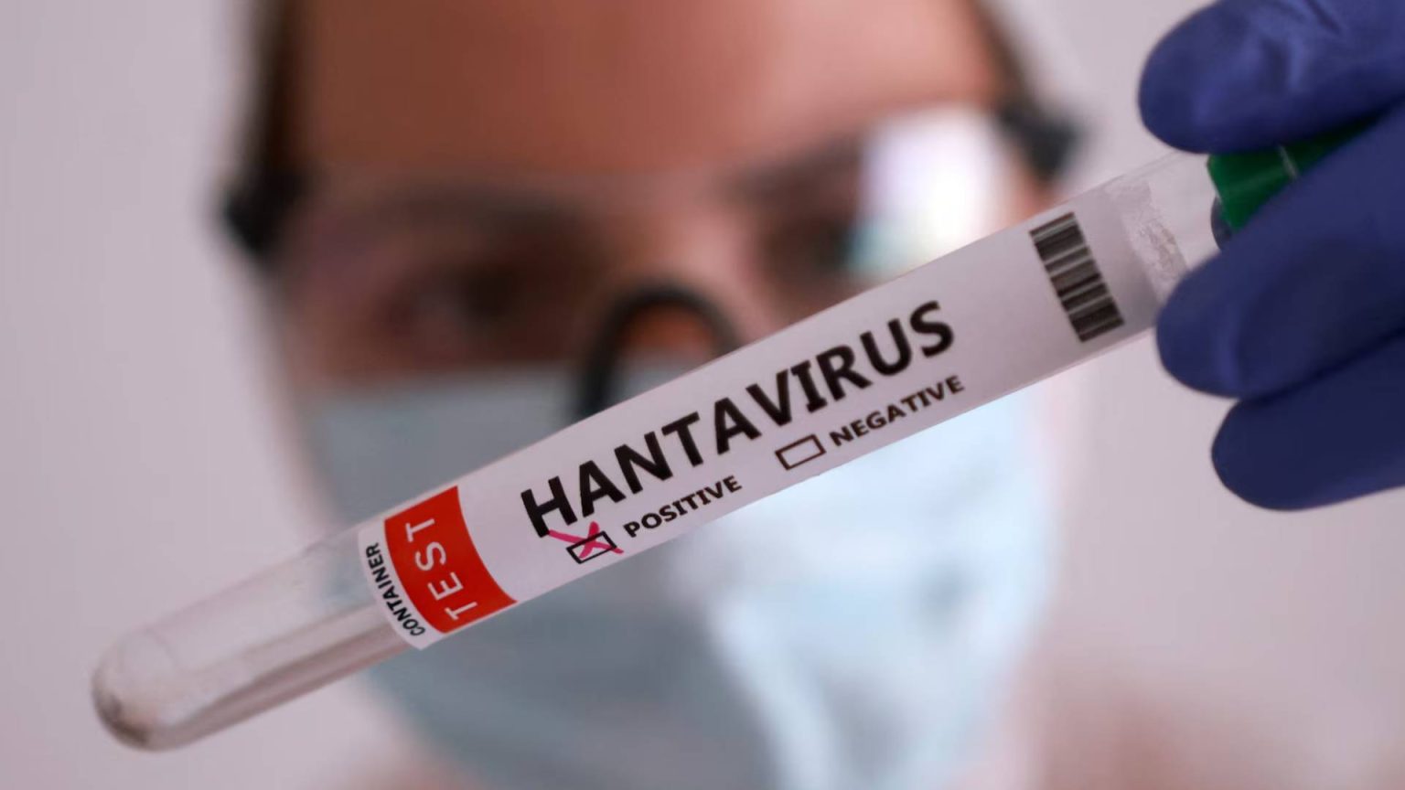 Outdated Hantavirus Post Sparks Fresh Online Controversy