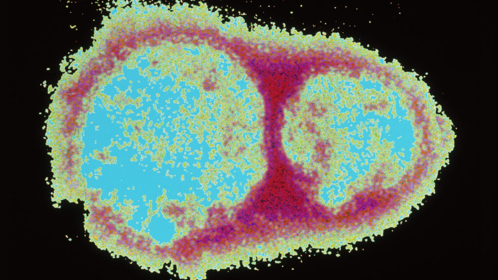 Hantavirus Outbreak: Misinformation Spreading Faster Than the Virus